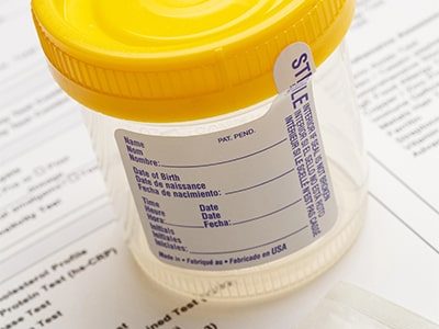 Drug Screening